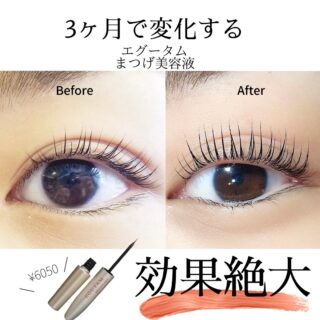 EGUTAM まつ毛美容液 3本セット 楽天市場】エグータム まつげ美容液 2ml 3個セット EGUTAM